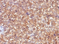 alpha-Fetoprotein/AFP Antibody (C2), Novus Biologicals 0.2mg; Unlabeled:Antibodies,